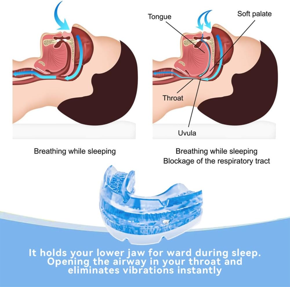ComfortFit | Adjustable Anti-Snoring Mouthpiece with Custom Fit | Ergonomic Design for Enhanced Sleep Quality 8