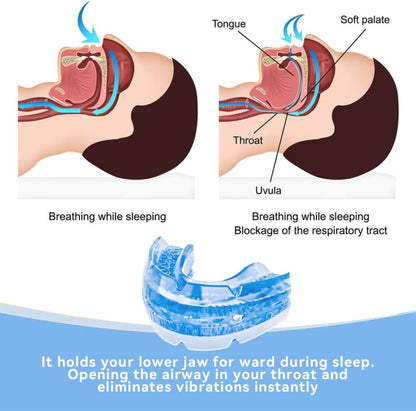 ComfortFit | Adjustable Anti-Snoring Mouthpiece with Custom Fit | Ergonomic Design for Enhanced Sleep Quality 8
